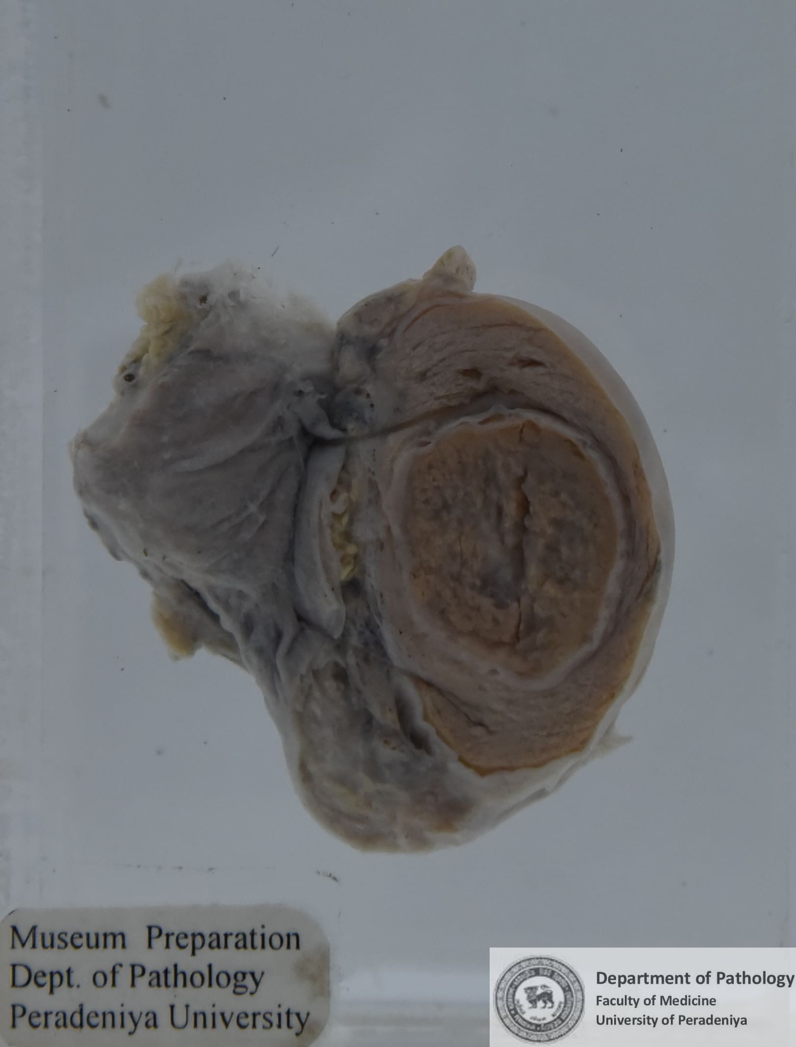 IX.16