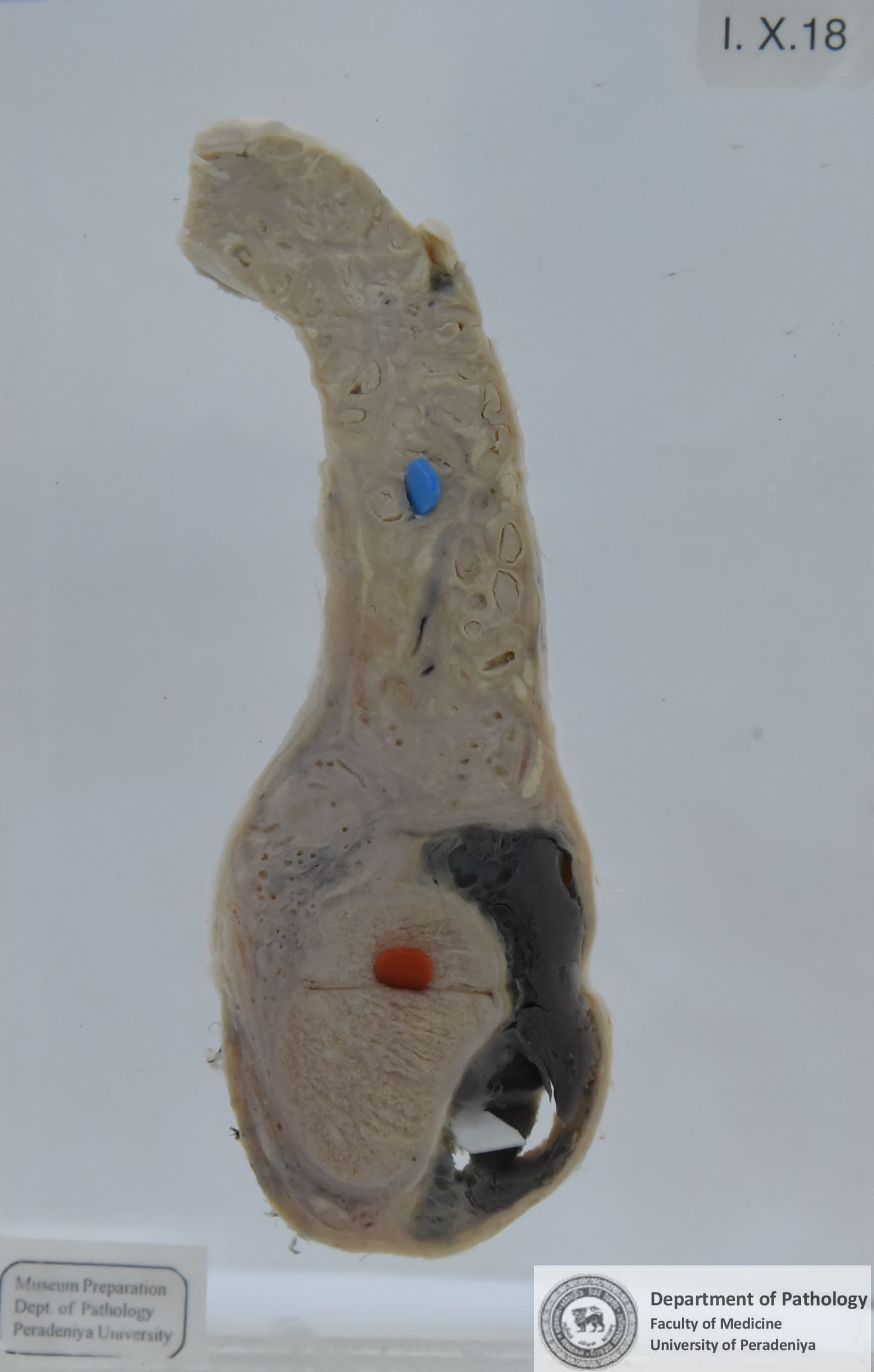 IX.18