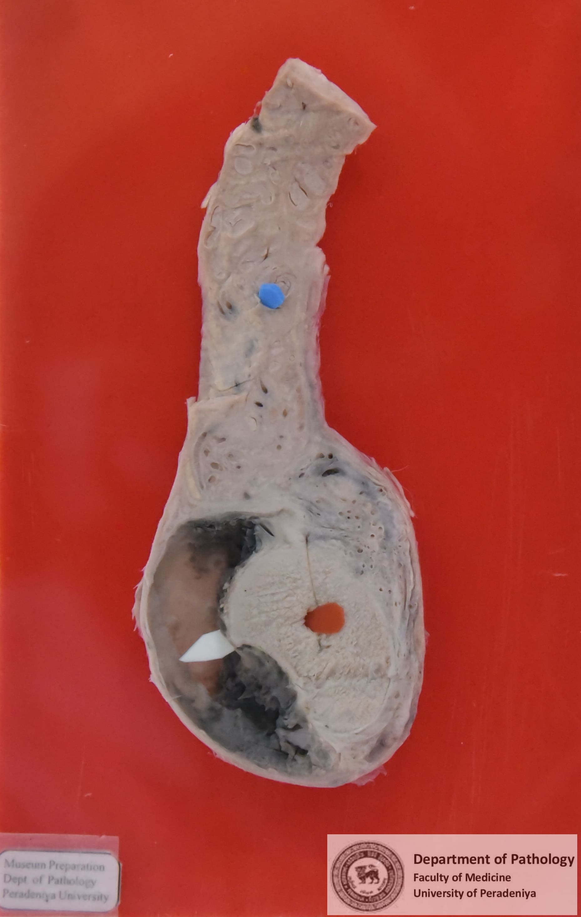 IX.19