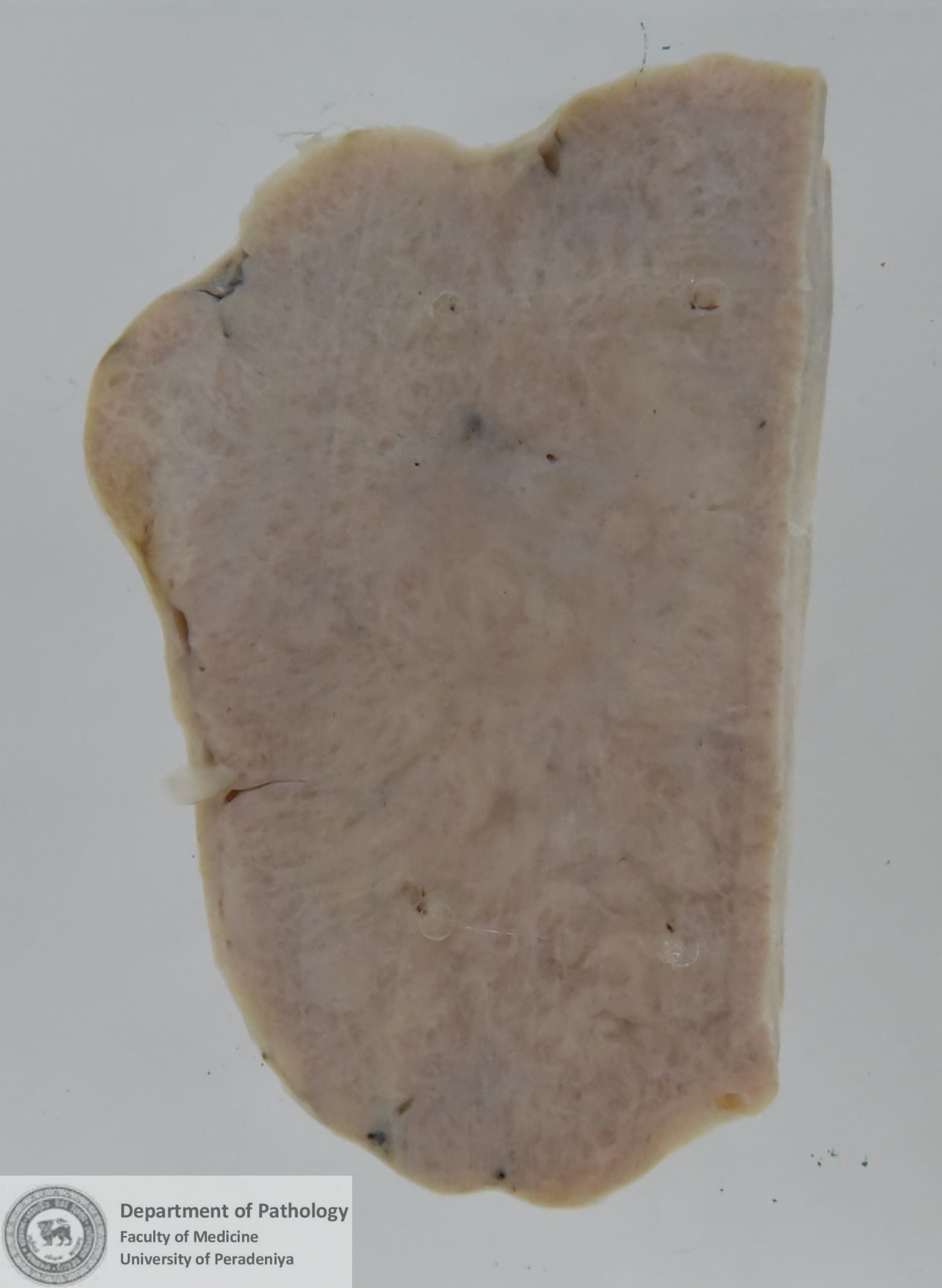 KX.69