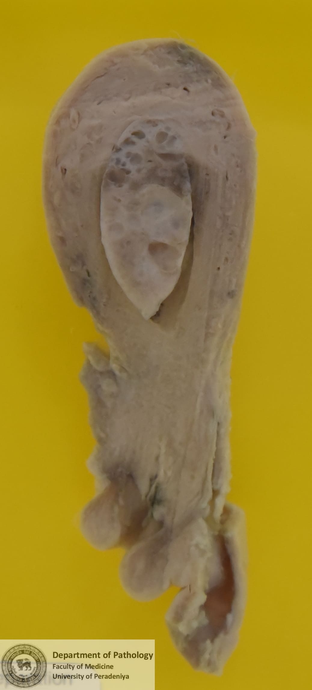 KX.73