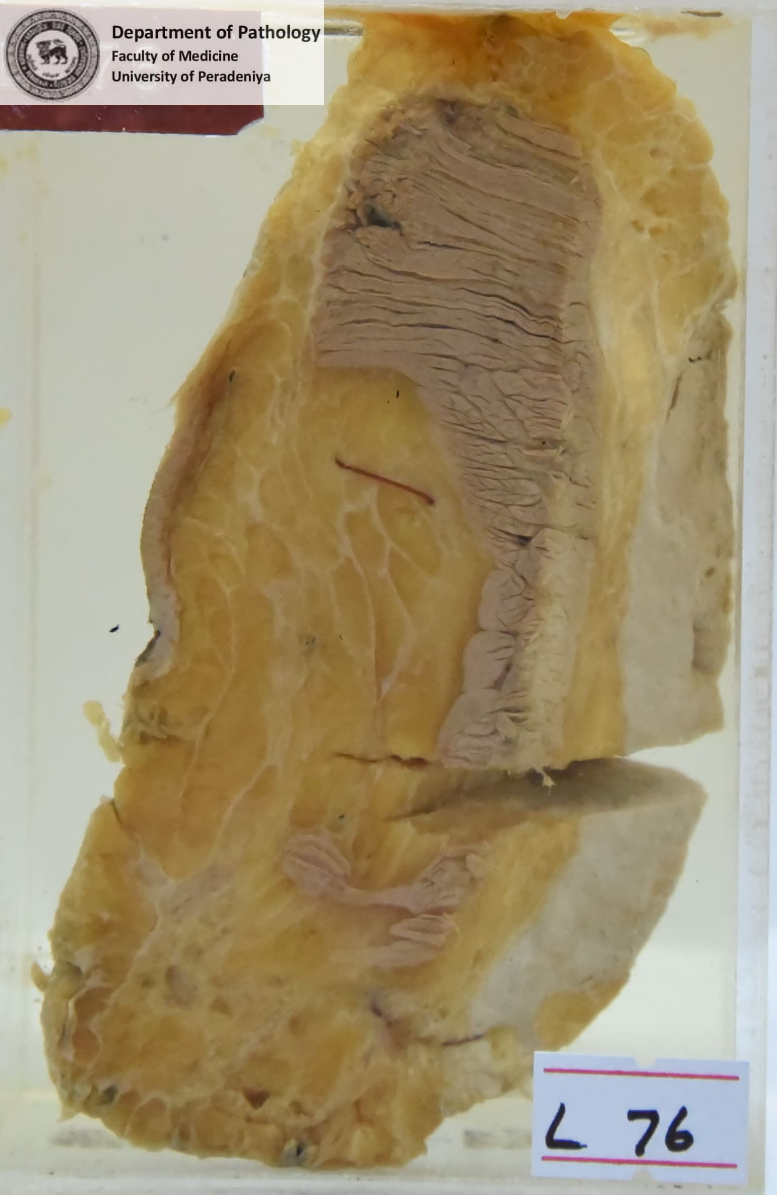 L.76