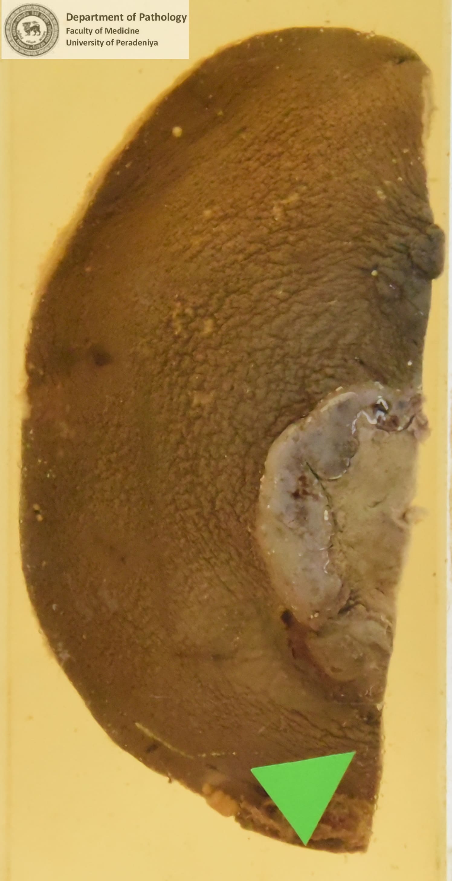 LX.9