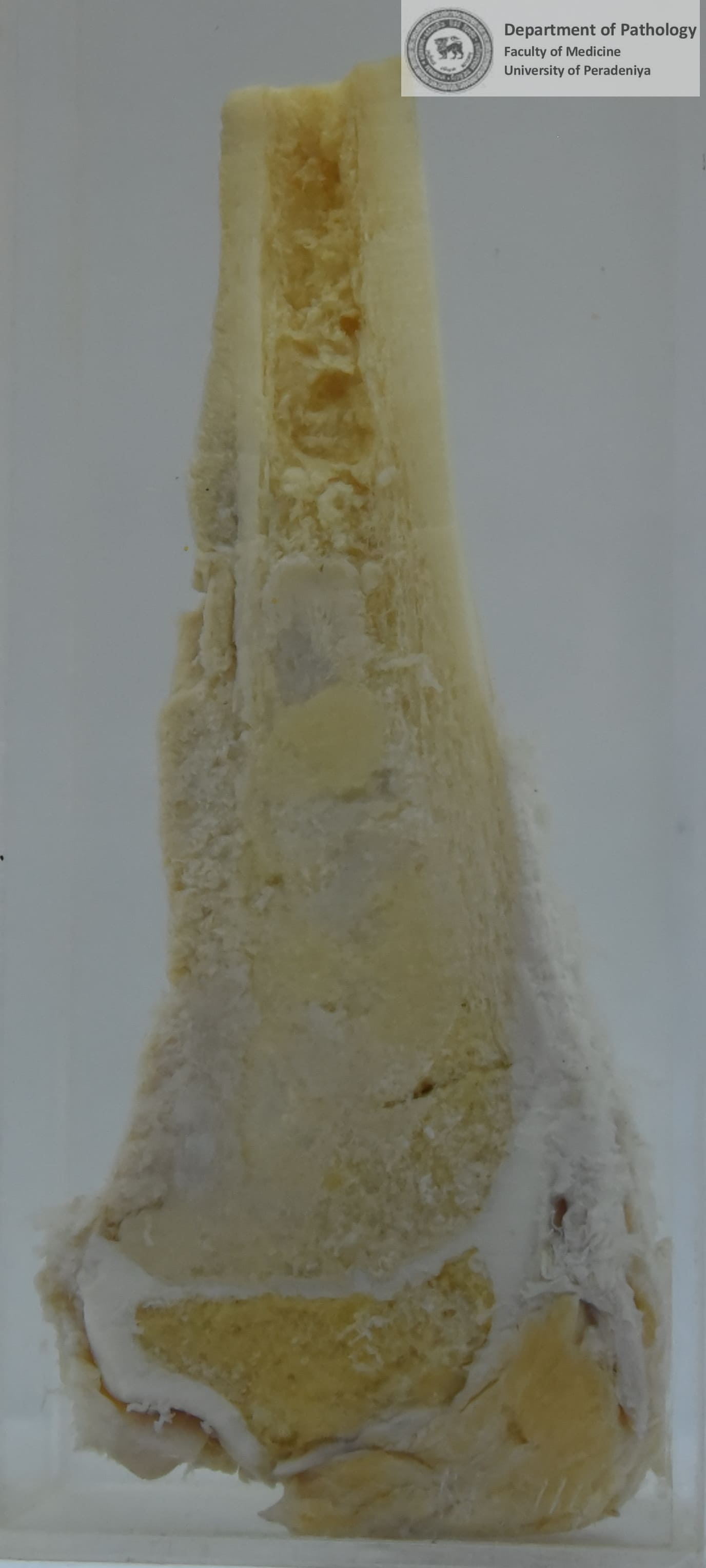 N.114