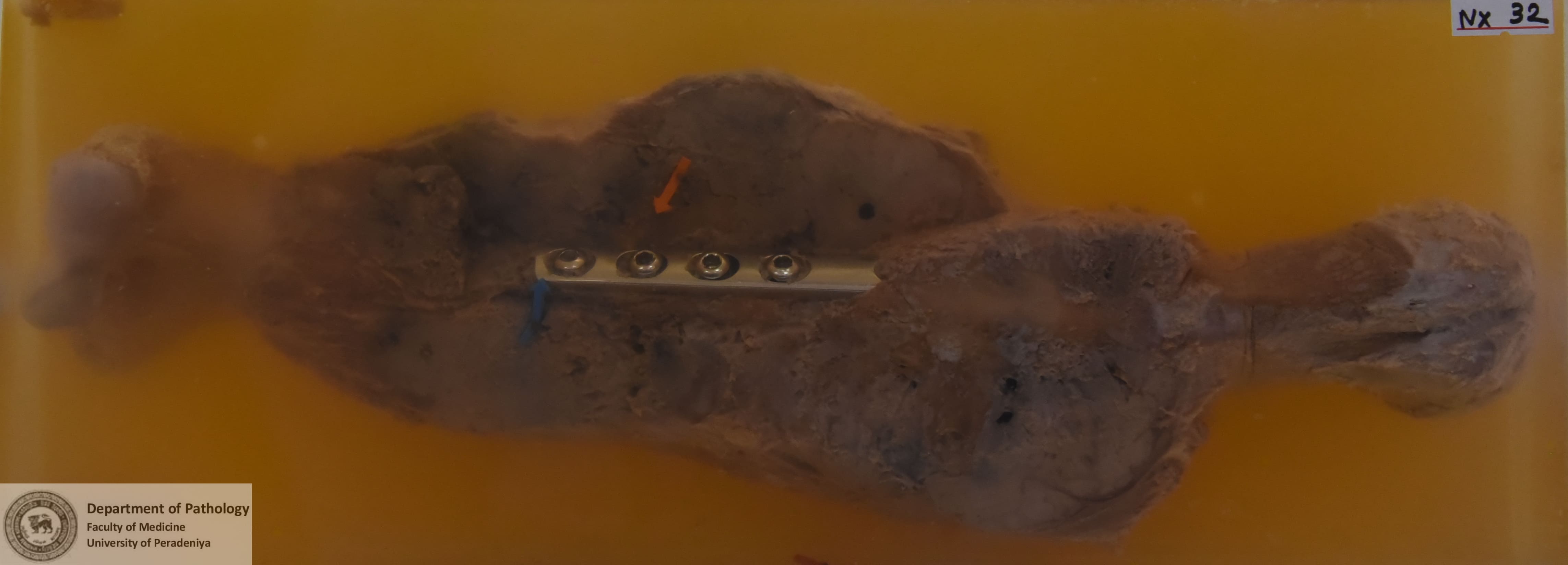 NX.32