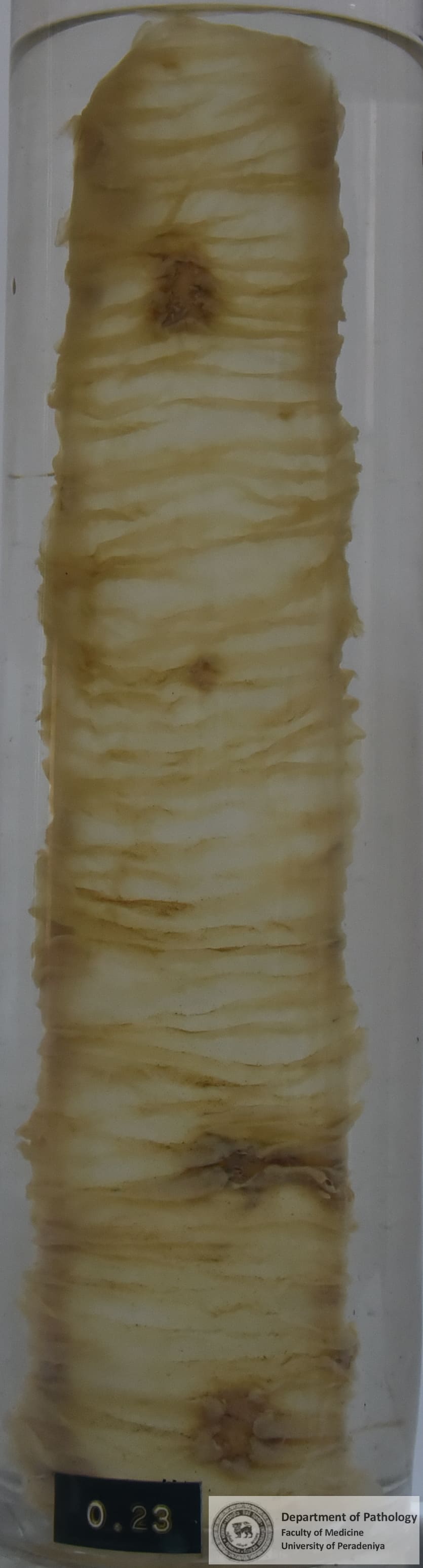 O.23