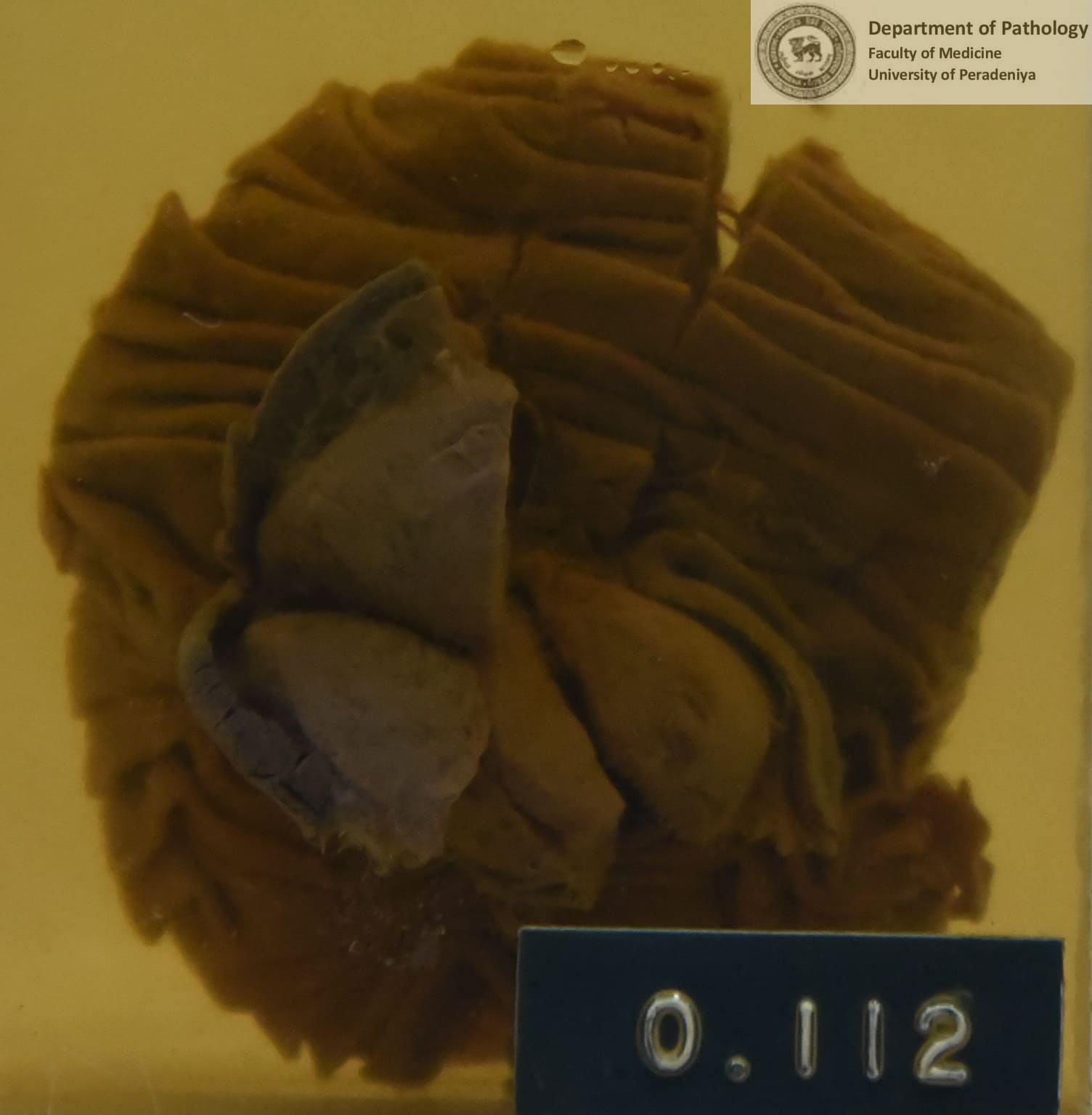 O.112