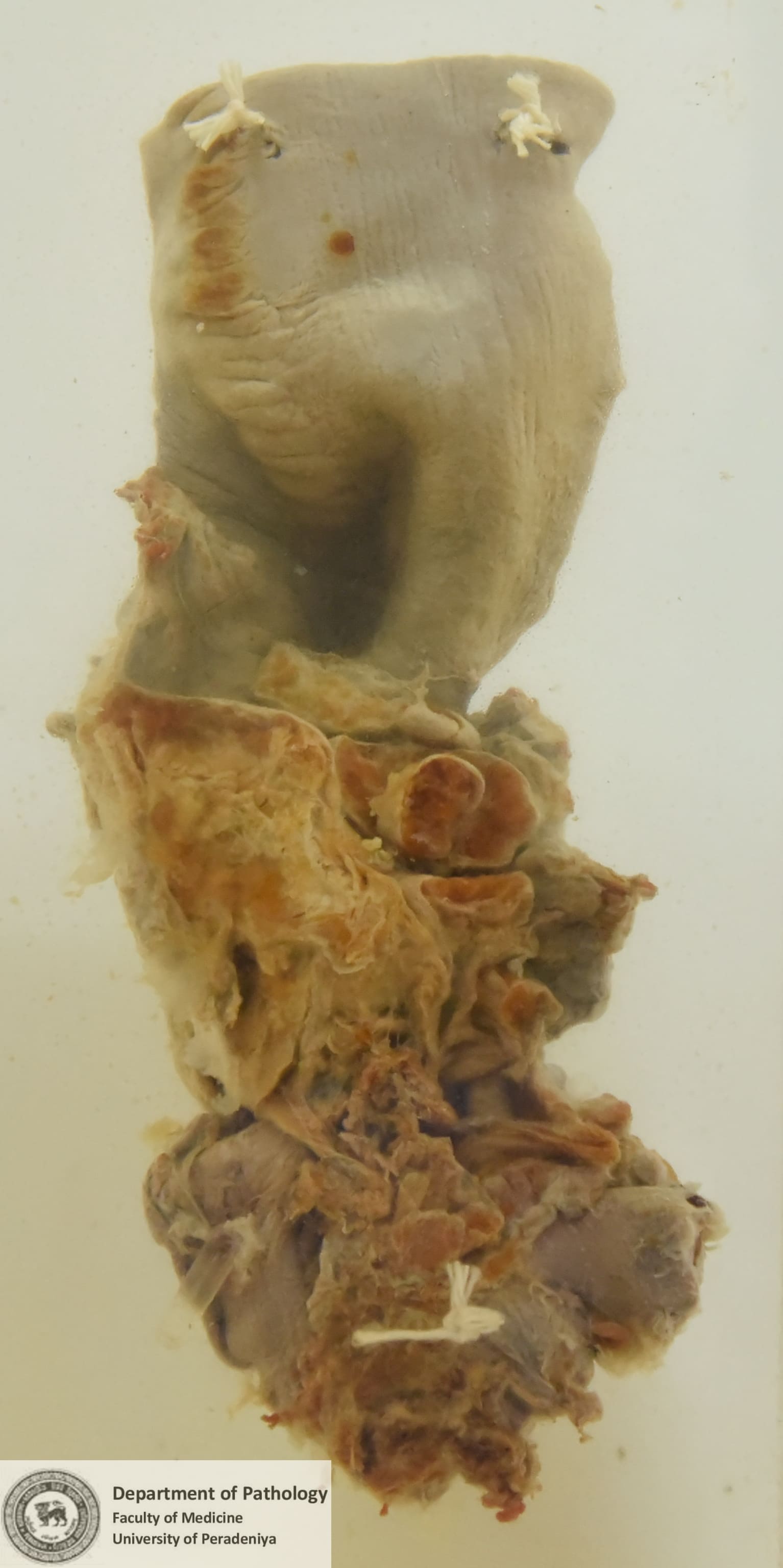 OX.1