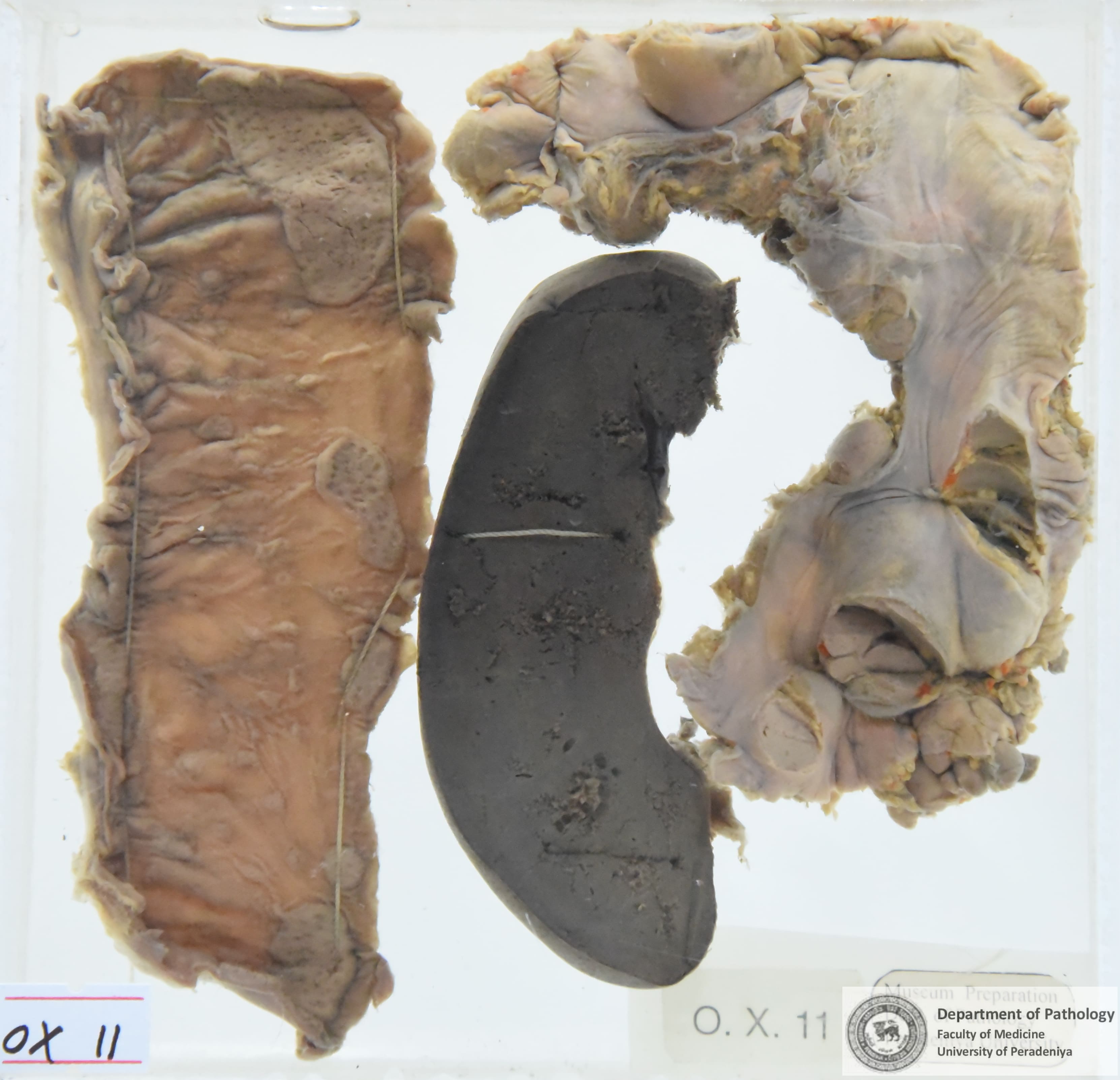 OX.11