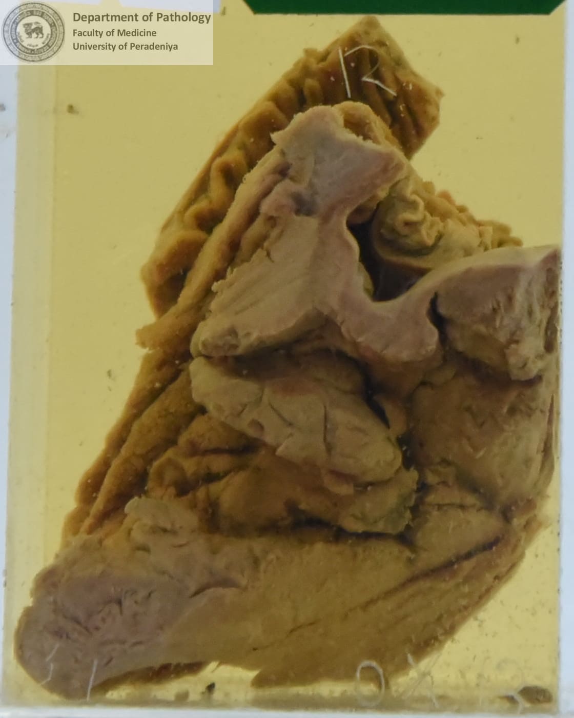 OX.13