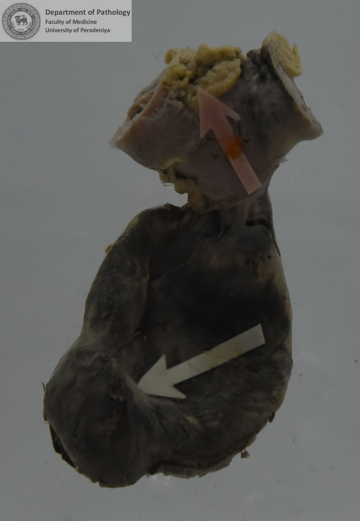 OX.27