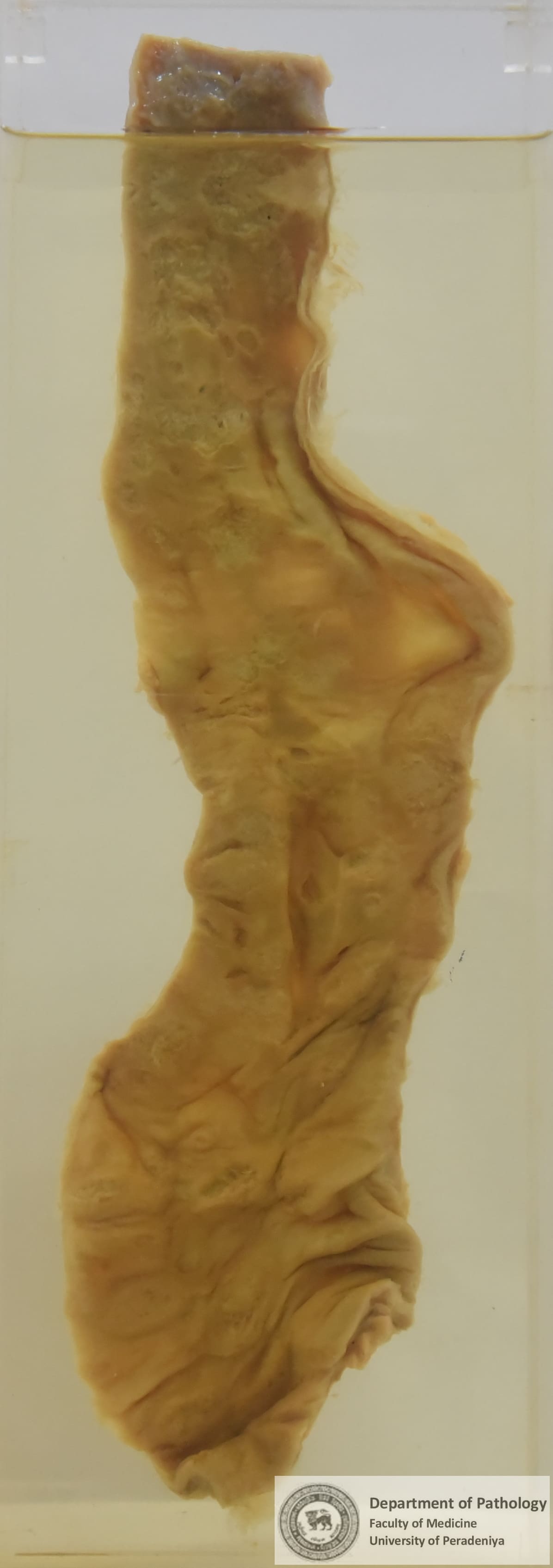 P.1