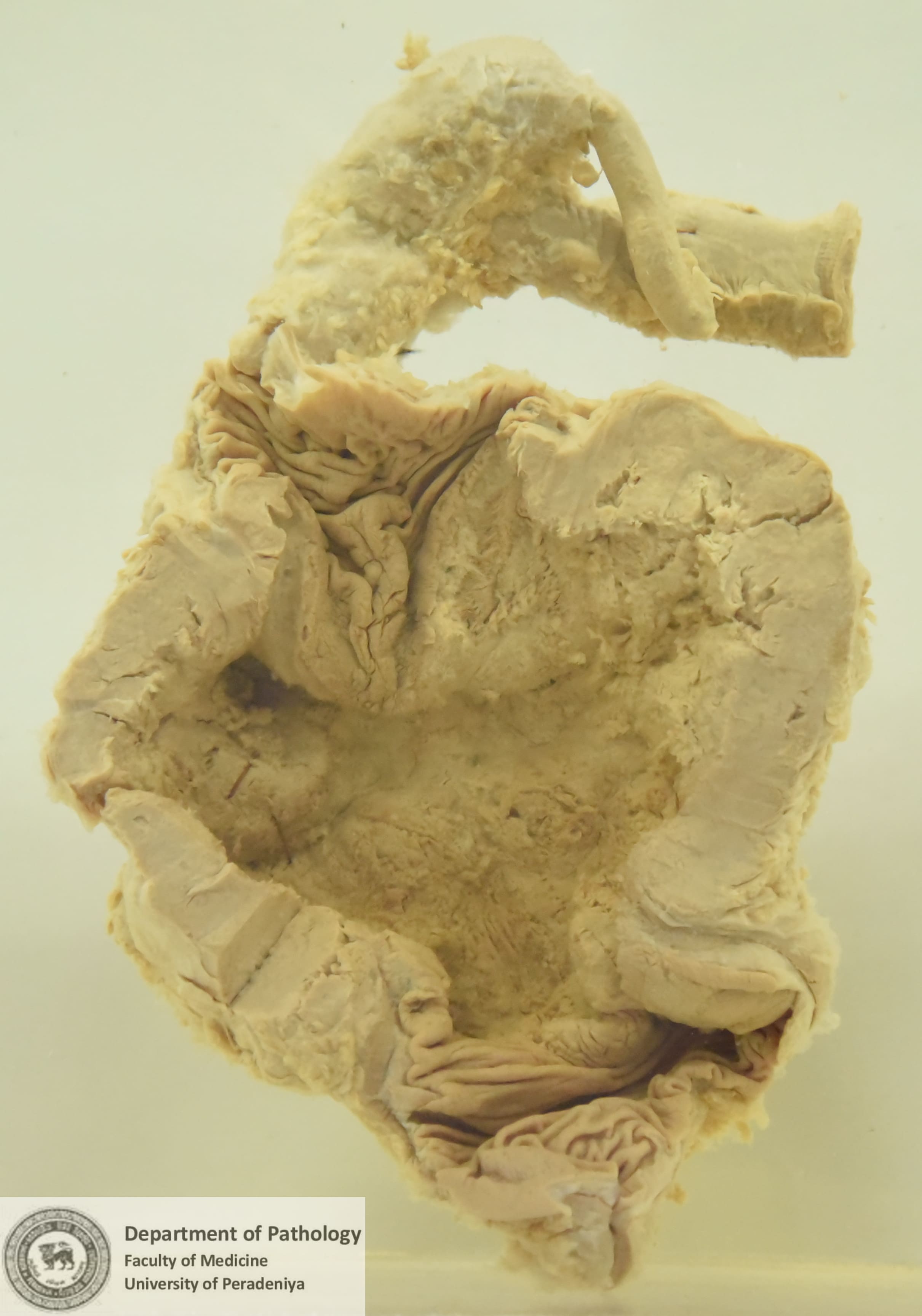 P.2