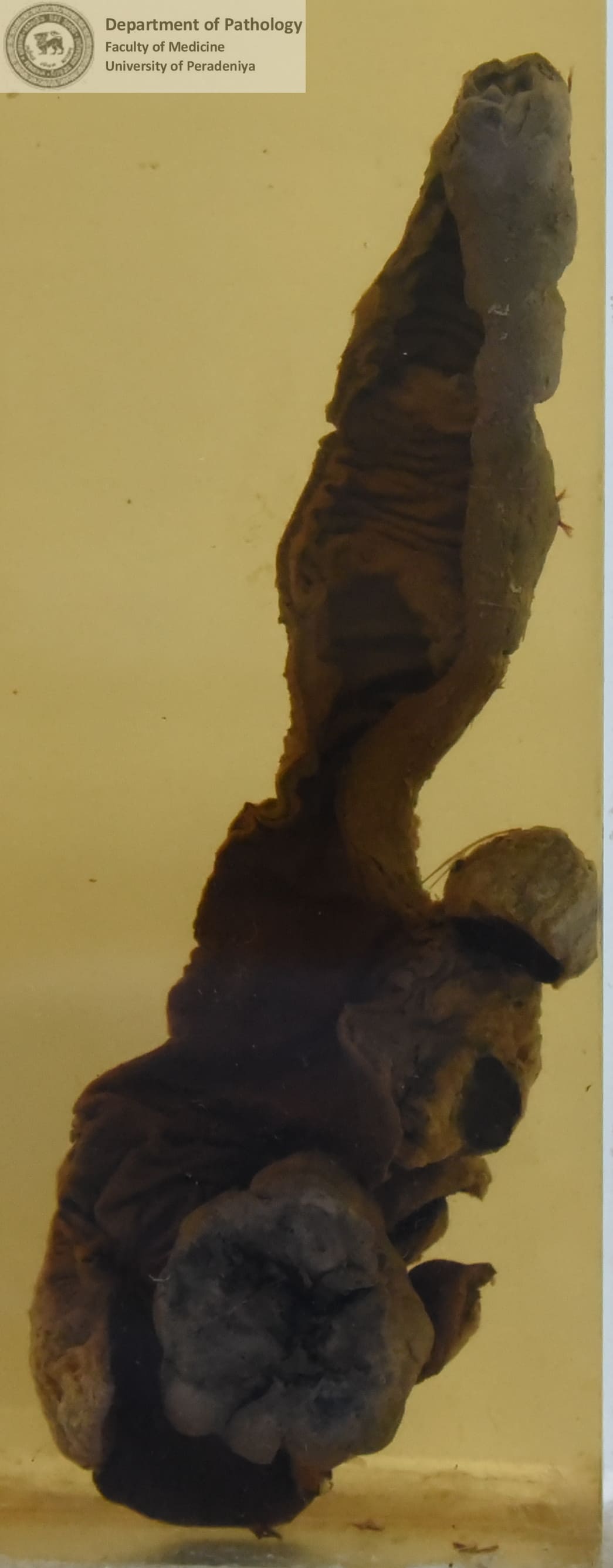 P.4