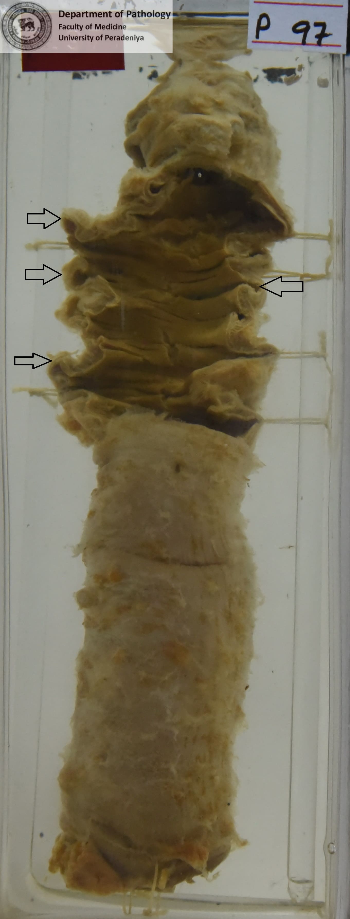 P.97
