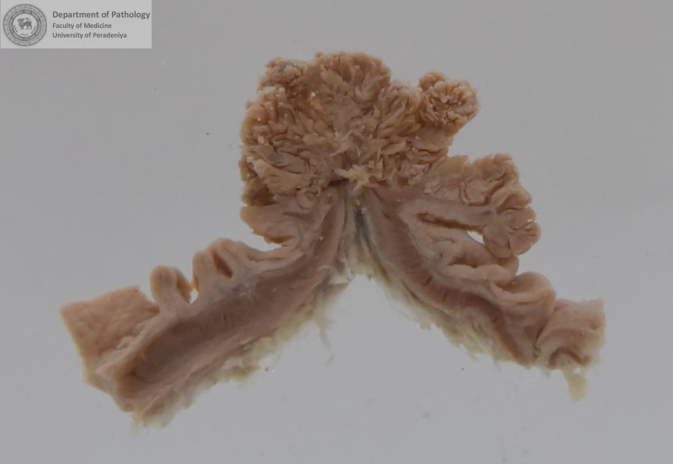 PX.66
