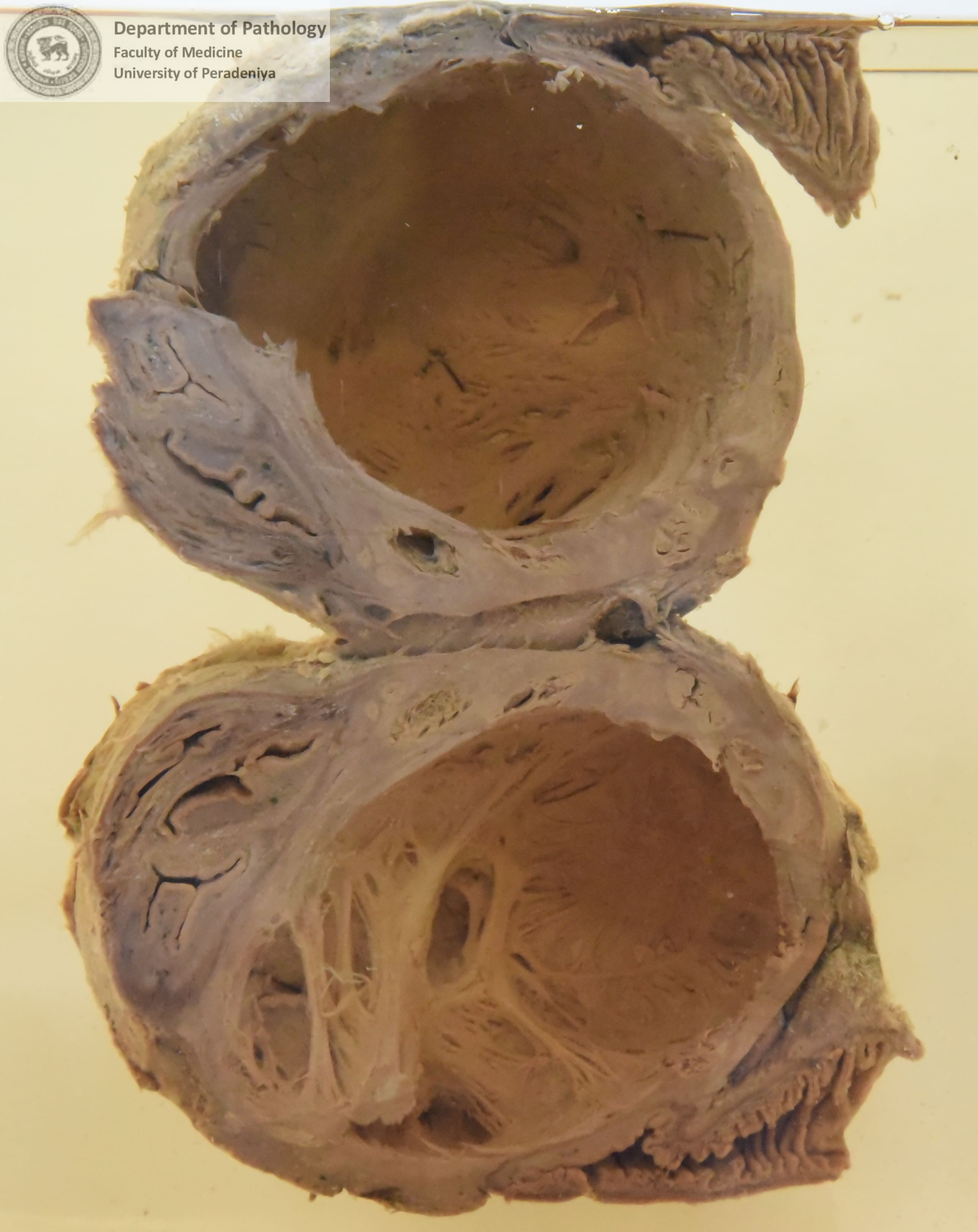 Q.1