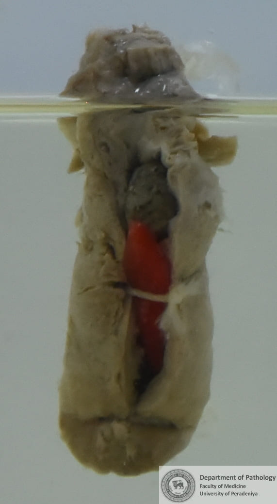 QX.3