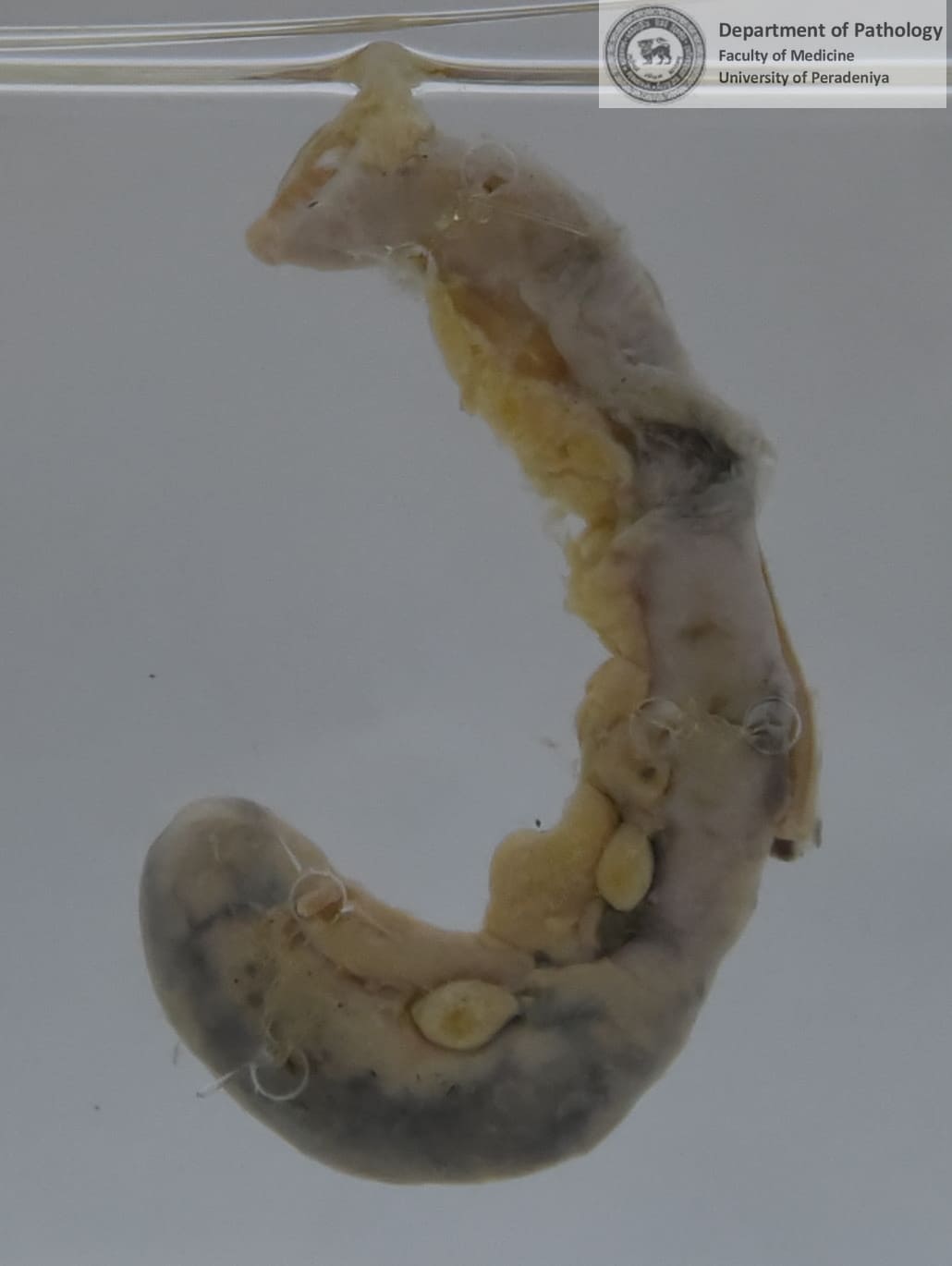 QX.9
