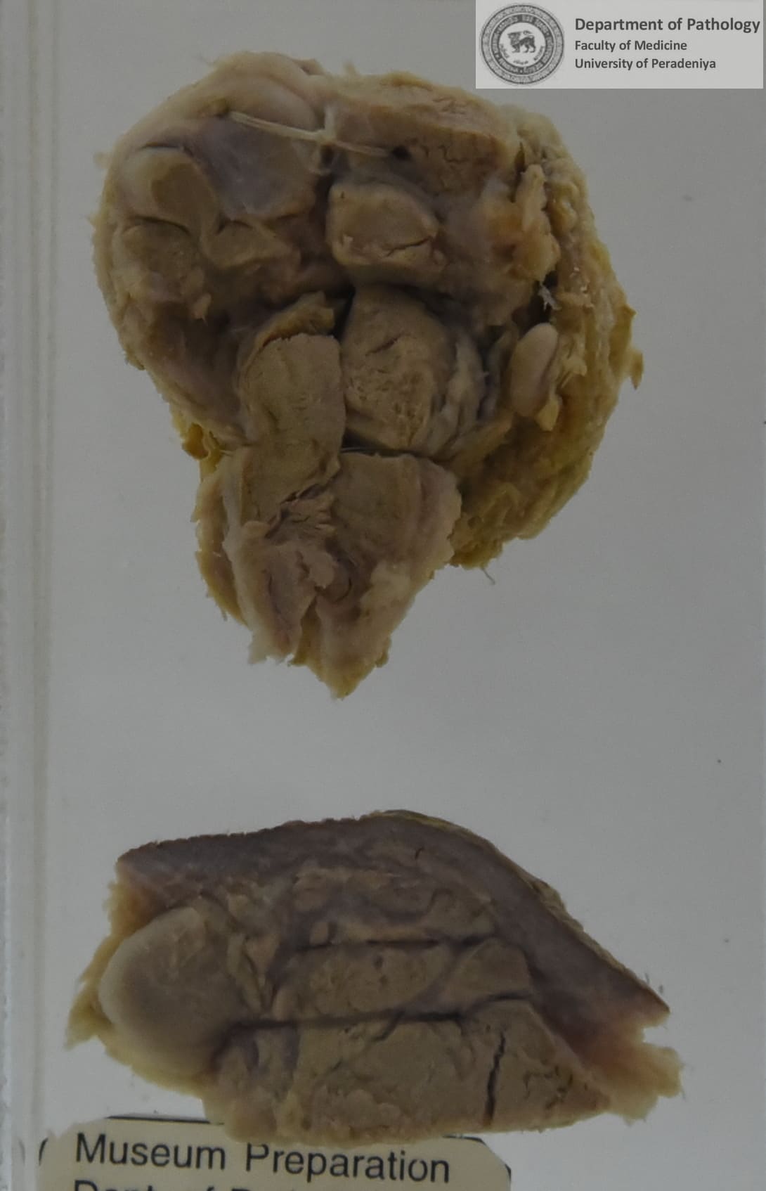 SX.3
