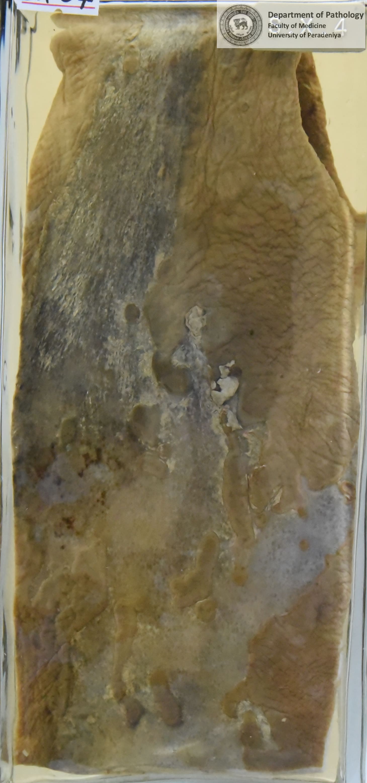 SX.4