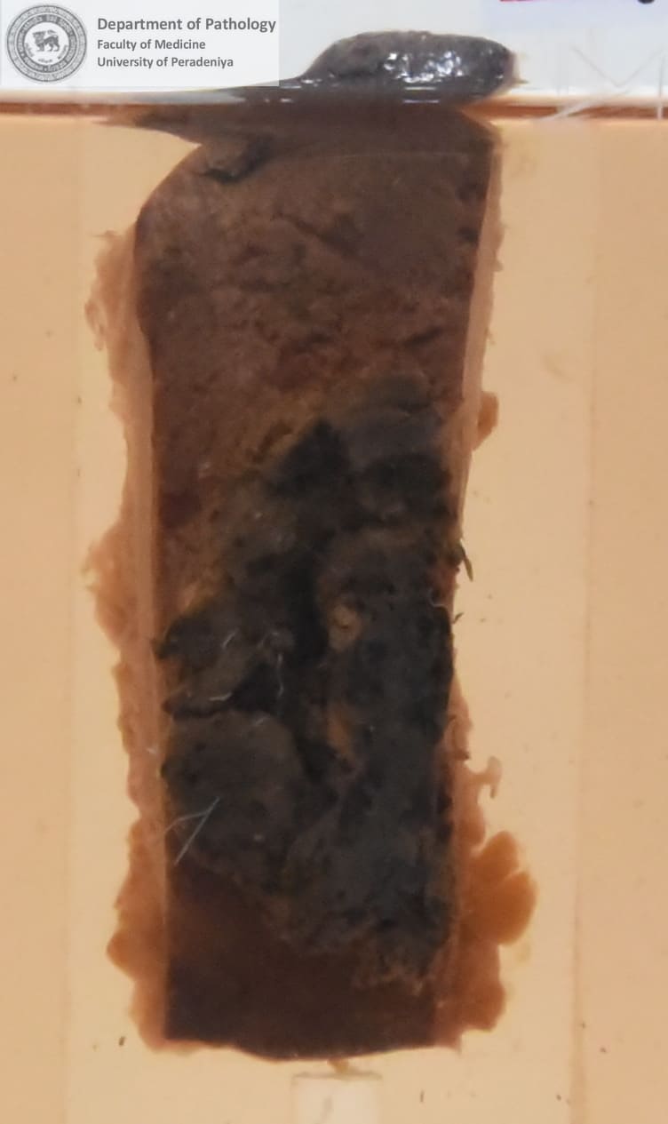 SX.6