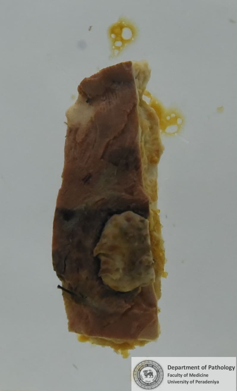 SX.11