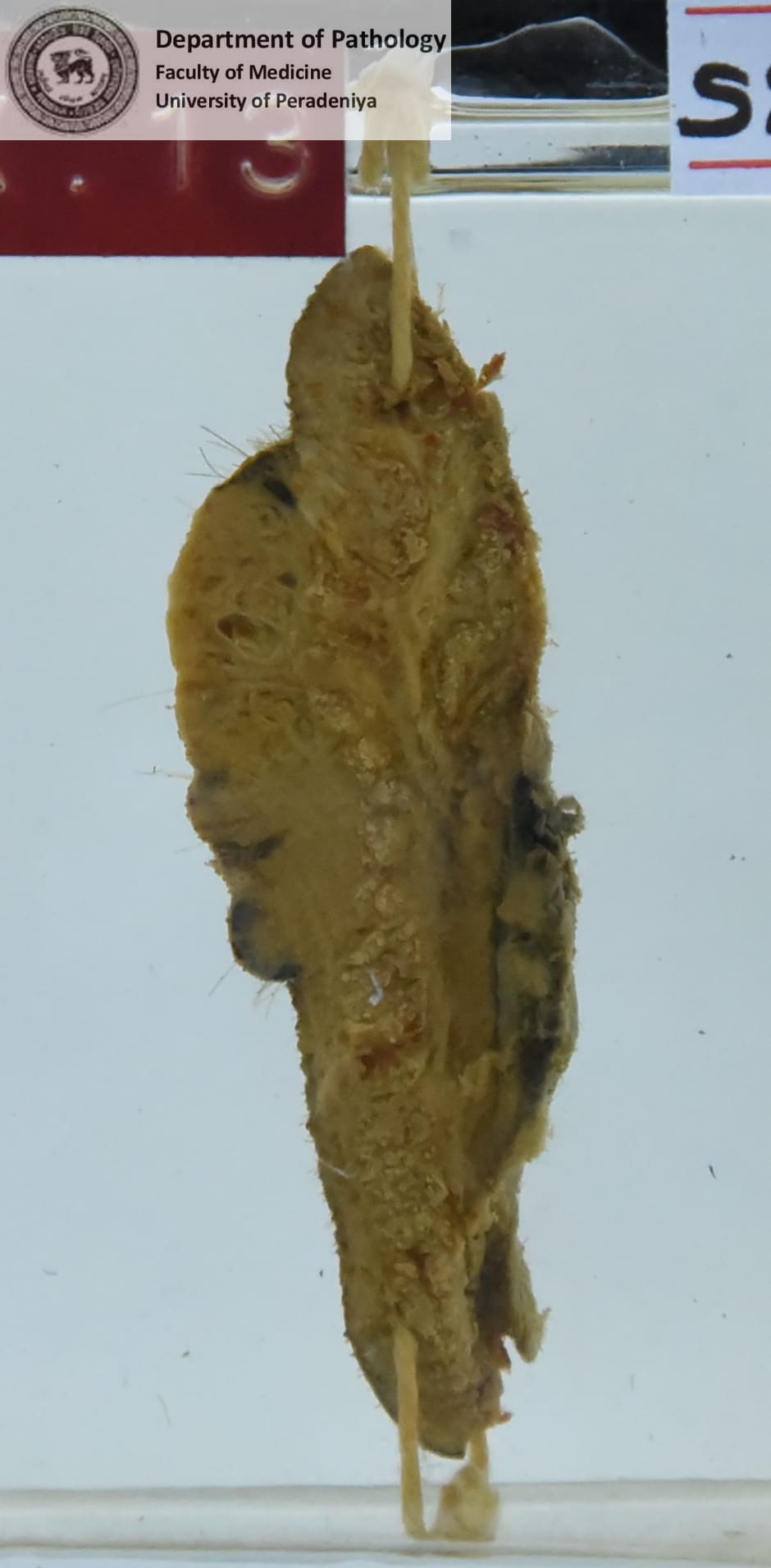SX.13