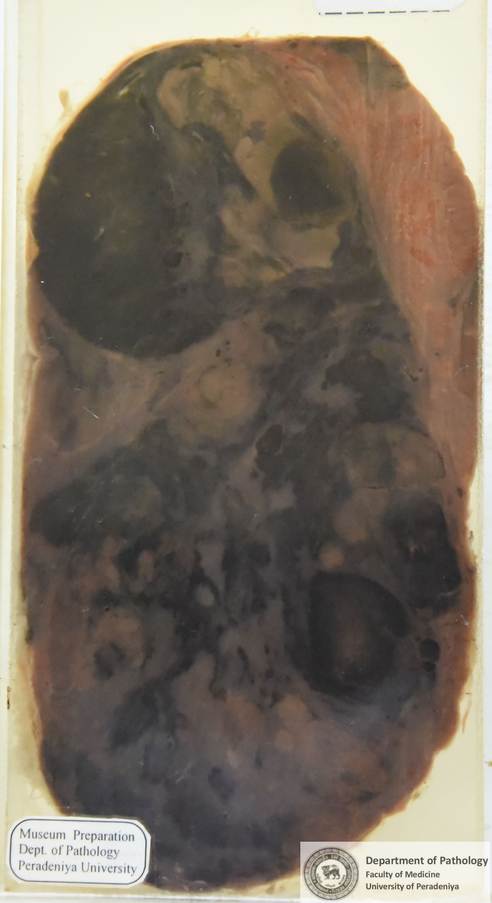 VX.6