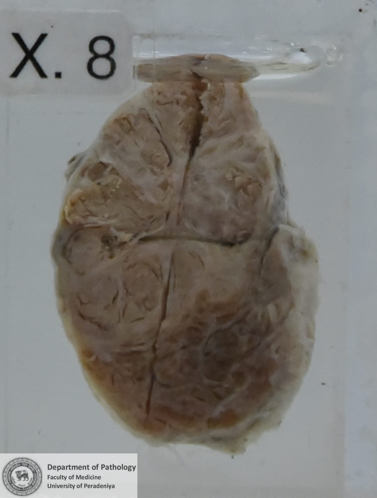 VX.8
